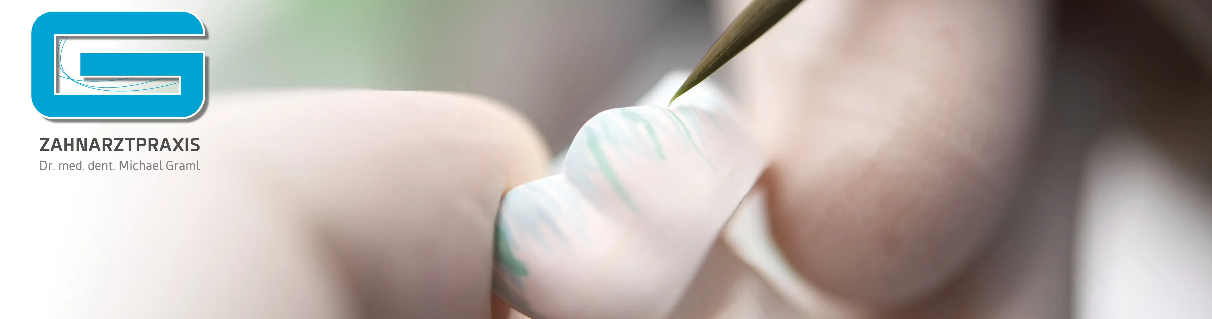 Das Bild zeigt eine Nahaufnahme eines Zahnersatzes, der gerade von einem Zahnarzt oder Zahntechniker mit einem feinen Instrument bearbeitet wird. Der Zahnersatz, möglicherweise eine Zahnkrone oder ein Inlay, wird sorgfältig mit einem Pinsel bestrichen, was darauf hinweist, dass gerade eine letzte Verfeinerung oder Reinigung stattfindet. Der Fokus liegt auf der Präzision und Sorgfalt der Arbeit, die in die Fertigstellung des Zahnersatzes fließt. Die Textur und Transluzenz des Materials sind deutlich erkennbar, was die Qualität und Detailgenauigkeit der zahnmedizinischen Prothetik unterstreicht. Dr. med. dent. Michael Graml. Im Vordergrund sieht man einen Zahnarzt oder eine Assistentin, die in blauen Handschuhen eine zahnmedizinische Behandlung oder zahnreinigung durchführt.  Der Hintergrund ist unscharf, um die Aufmerksamkeit auf die zentrale Tätigkeit zu lenken.