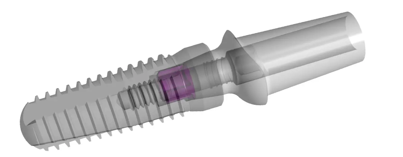 Das dargestellte Bild zeigt eine technische Illustration eines zweiteiligen dentalen Implantatsystems in transparenter 3D-Ansicht. Der Implantatkörper, der im linken Bereich des Bildes zu sehen ist, besitzt ein schraubenförmiges Gewinde, das für die stabile Verankerung im Kieferknochen sorgt. Im rechten Bereich befindet sich das Abutment, welches als Verbindungselement zwischen dem Implantat und der späteren Zahnkrone dient.

Besonders auffällig ist das violett hervorgehobene Bauteil im Inneren des Implantats – hierbei handelt es sich vermutlich um eine Fixierschraube oder ein konisches Verbindungselement. Diese Komponente gewährleistet eine stabile, spannungsfreie Verbindung zwischen Implantatkörper und Abutment und trägt maßgeblich zur Langlebigkeit und Funktionalität des gesamten Systems bei.

Durch die halbtransparente Darstellung wird das Innenleben des Implantats sichtbar gemacht, was eine genaue Betrachtung der mechanischen Verbindungen ermöglicht. Solche Visualisierungen werden häufig in der dentalen Implantologie eingesetzt, um die Funktionsweise und den Aufbau von Implantatsystemen anschaulich zu erklären.