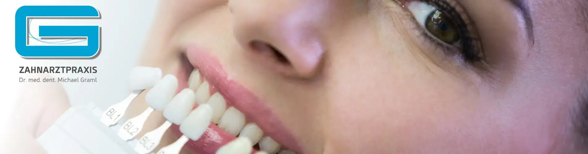 Das Bild zeigt eine junge Frau, die beim Zahnarzt eine Farbabgleichung für Zahnimplantate oder -kronen durchführt. Sie hält eine Palette mit verschiedenen Zahnfarben neben ihren eigenen Zähnen, um die perfekte Farbe für ihre Zahnprothetik zu finden. Ihr Gesichtsausdruck ist freundlich und zufrieden, was darauf hindeutet, dass sie aktiv an der Auswahl beteiligt ist und wahrscheinlich mit dem Prozess und den Ergebnissen zufrieden ist. Der Fokus liegt auf der Farbpalette und ihrem Gesicht, was die Bedeutung der ästhetischen Abstimmung in der zahnmedizinischen Behandlung betont.